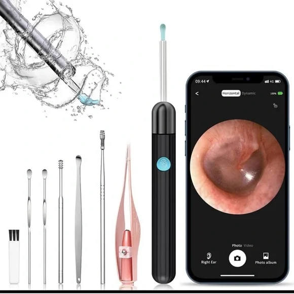 Ear Wax Removal, Ear Cleaner Camera with 1080P, 6 Ear Pick, 8 Pcs Ear Set White - Picture 1 of 8